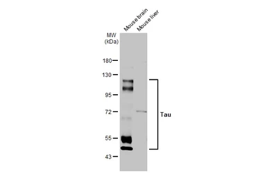 Anti-Tau antibody [HL2736] used in Western Blot (WB). GTX639564