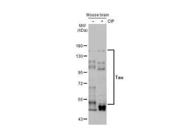 Anti-Tau antibody [HL2736] used in Western Blot (WB). GTX639564