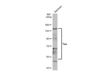 Anti-Tau antibody [HL2736] used in Western Blot (WB). GTX639564