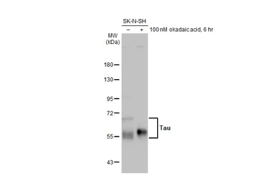 Anti-Tau antibody [HL2736] used in Western Blot (WB). GTX639564