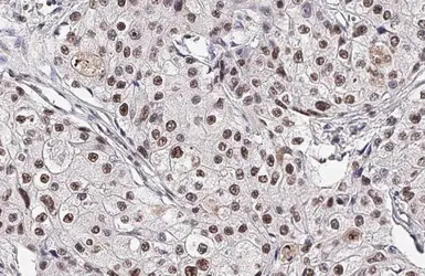Anti-p38 MAPK (phospho Thr180 / Tyr182) antibody [HL2741] used in IHC (Paraffin sections) (IHC-P). GTX639570