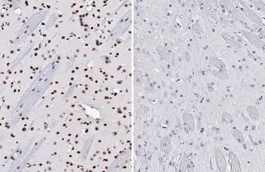 Anti-p38 MAPK (phospho Thr180 / Tyr182) antibody [HL2741] used in IHC (Paraffin sections) (IHC-P). GTX639570