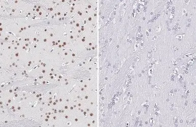 Anti-p38 MAPK (phospho Thr180 / Tyr182) antibody [HL2741] used in IHC (Paraffin sections) (IHC-P). GTX639570