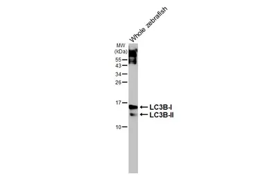 Anti-LC3B antibody [HL2798] used in Western Blot (WB). GTX639686