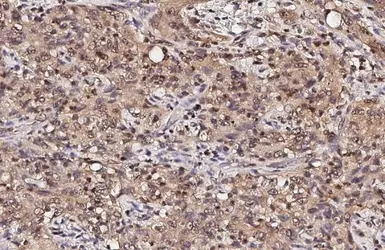 Anti-LC3B antibody [HL2798] used in IHC (Paraffin sections) (IHC-P). GTX639686