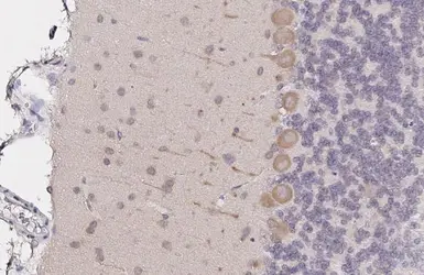 Anti-LC3B antibody [HL2798] used in IHC (Paraffin sections) (IHC-P). GTX639686