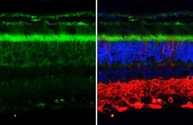 Anti-P2Y2 antibody [HL2801] used in IHC (Paraffin sections) (IHC-P). GTX639689