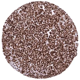 Anti-HMGA2 antibody [HMV314] HistoMAX&trade; used in IHC (Paraffin sections) (IHC-P). GTX639938