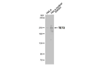 Anti-TET2 antibody [HL2822] used in Western Blot (WB). GTX640093