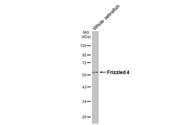 Anti-Frizzled 4 antibody [HL2824] used in Western Blot (WB). GTX640095