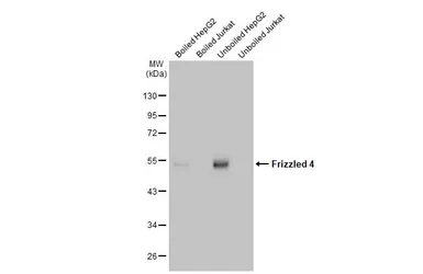 Anti-Frizzled 4 antibody [HL2824] used in Western Blot (WB). GTX640095