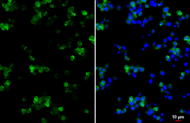 Anti-CCR2 antibody [HL2838] used in Immunocytochemistry/ Immunofluorescence (ICC/IF). GTX640109