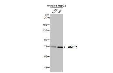 Anti-AMFR antibody [HL2866] used in Western Blot (WB). GTX640143
