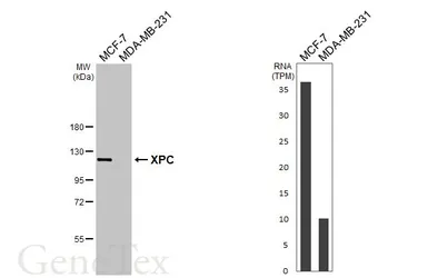 Anti-XPC antibody [HL2894] used in Western Blot (WB). GTX640231