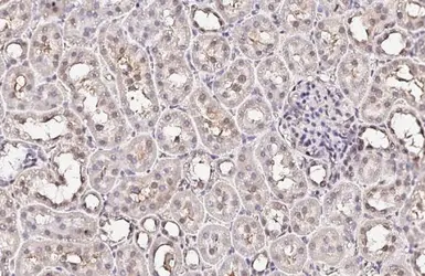 Anti-XPC antibody [HL2894] used in IHC (Paraffin sections) (IHC-P). GTX640231