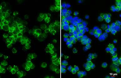 Anti-TGF beta Receptor III antibody [HL2895] used in Immunocytochemistry/ Immunofluorescence (ICC/IF). GTX640232