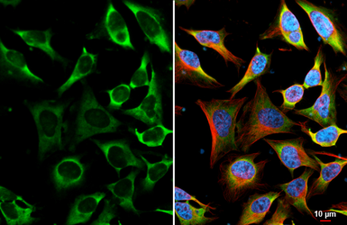 Anti-YTHDF2 antibody [HL2910] used in Immunocytochemistry/ Immunofluorescence (ICC/IF). GTX640253