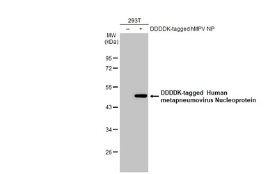 Anti-Human metapneumovirus Nucleoprotein antibody [HL2919] used in Western Blot (WB). GTX640262