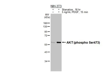 Anti-AKT (phospho Ser473) antibody [HL2971] used in Western Blot (WB). GTX640358