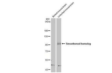 Anti-Smoothened homolog antibody [HL2975] used in Western Blot (WB). GTX640362