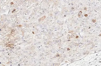 Anti-PD-L1 antibody [HL2985] used in IHC (Paraffin sections) (IHC-P). GTX640395