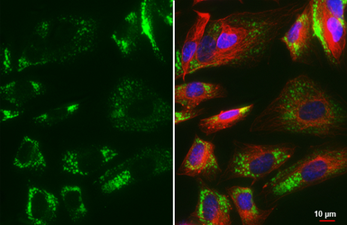Anti-COL1A1 antibody [HL3040] used in Immunocytochemistry/ Immunofluorescence (ICC/IF). GTX640483