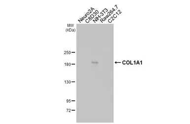 Anti-COL1A1 antibody [HL3040] used in Western Blot (WB). GTX640483
