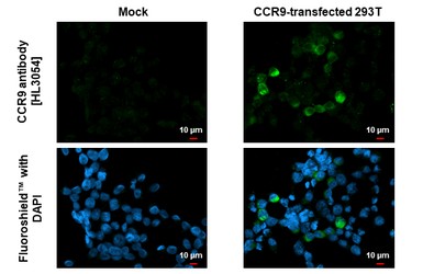 Anti-CCR9 antibody [HL3054] used in Immunocytochemistry/ Immunofluorescence (ICC/IF). GTX640497