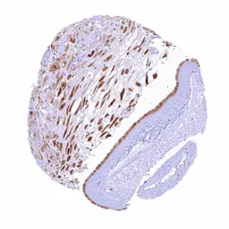 Anti-PAI2 antibody [HMV330] HistoMAX&trade; used in IHC (Paraffin sections) (IHC-P). GTX640562