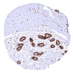 Anti-PAI2 antibody [HMV330] HistoMAX&trade; used in IHC (Paraffin sections) (IHC-P). GTX640562