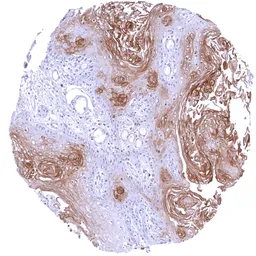 Anti-PAI2 antibody [HMV330] HistoMAX&trade; used in IHC (Paraffin sections) (IHC-P). GTX640562