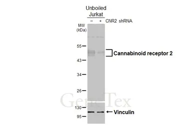 Anti-Cannabinoid receptor 2 antibody [HL3120] used in Western Blot (WB). GTX640596