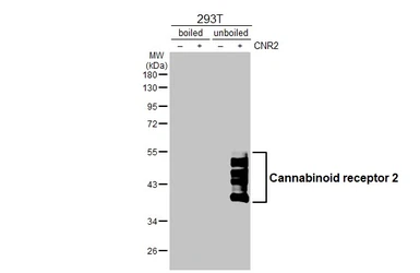 Anti-Cannabinoid receptor 2 antibody [HL3120] used in Western Blot (WB). GTX640596