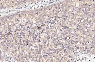Anti-NDP52 antibody [HL3126] used in IHC (Paraffin sections) (IHC-P). GTX640612