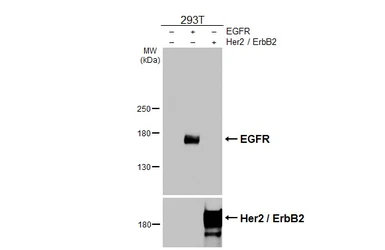 Anti-EGFR antibody [HL3153] used in Western Blot (WB). GTX640663