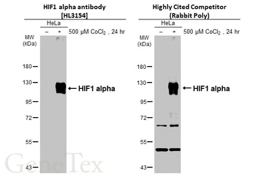 Anti-HIF1 alpha antibody [HL3154] used in Western Blot (WB). GTX640664