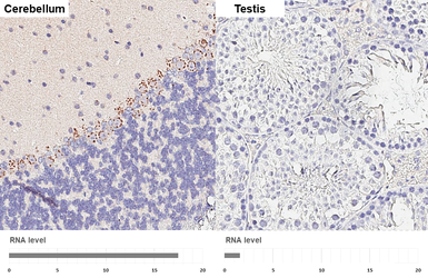 Anti-HIF1 alpha antibody [HL3154] used in IHC (Paraffin sections) (IHC-P). GTX640664