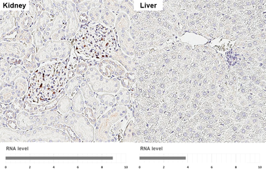 Anti-HIF1 alpha antibody [HL3154] used in IHC (Paraffin sections) (IHC-P). GTX640664