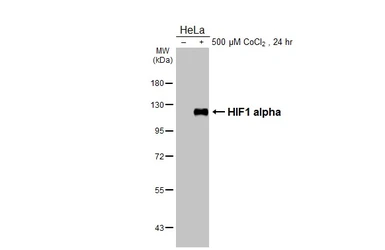 Anti-HIF1 alpha antibody [HL3154] used in Western Blot (WB). GTX640664
