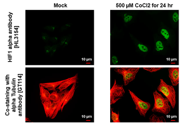 Anti-HIF1 alpha antibody [HL3154] used in Immunocytochemistry/ Immunofluorescence (ICC/IF). GTX640664