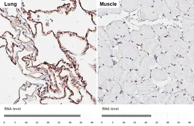 Anti-Claudin 5 antibody [HL3156] used in IHC (Paraffin sections) (IHC-P). GTX640666