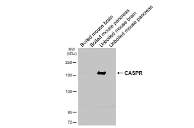 Anti-CASPR antibody [HL3160] used in Western Blot (WB). GTX640670