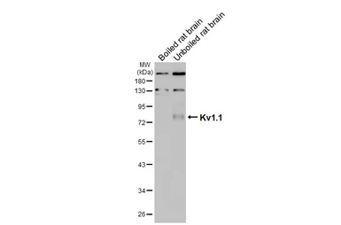 Anti-Kv1.1 antibody [HL3162] used in Western Blot (WB). GTX640672