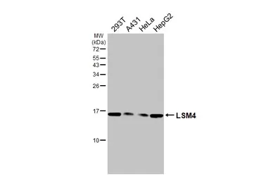 Anti-LSM4 antibody [HL3172] used in Western Blot (WB). GTX640690