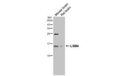 Anti-LSM4 antibody [HL3172] used in Western Blot (WB). GTX640690