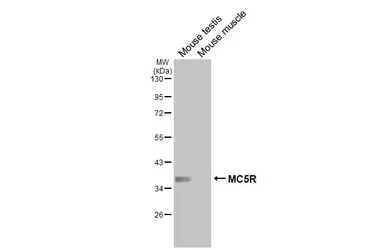 Anti-MC5 Receptor antibody [HL3178] used in Western Blot (WB). GTX640696