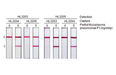 Anti-Mycoplasma pneumoniae P1 protein antibody [HL3205] used in Lateral Flow (Lateral Flow). GTX640845