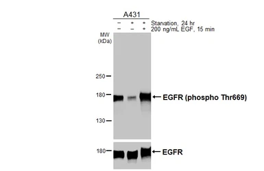 Anti-EGFR (phospho Thr669) antibody [HL3265] used in Western Blot (WB). GTX640912