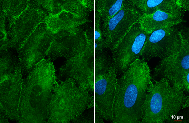 Anti-alpha 1d Adrenergic Receptor antibody [HL3267] used in Immunocytochemistry/ Immunofluorescence (ICC/IF). GTX640914
