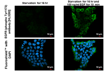 Anti-EGFR (phospho Tyr1173) antibody [HL3283] used in Immunocytochemistry/ Immunofluorescence (ICC/IF). GTX640937